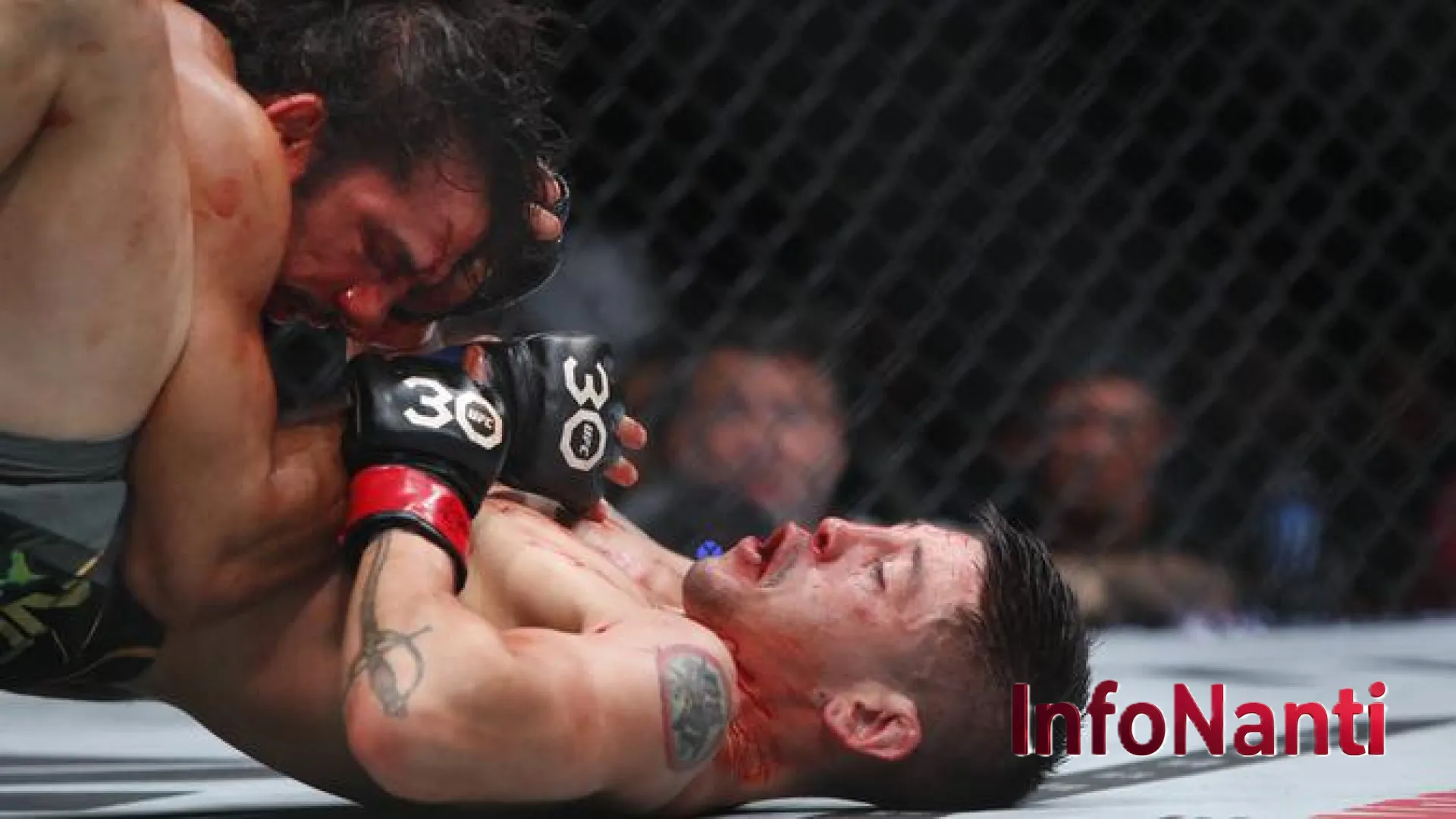 Fenomena Ekstrem Cauliflower Ear di Rusia: Mengapa Pria Sengaja Merusak Telinga demi Tampilan Sangar?